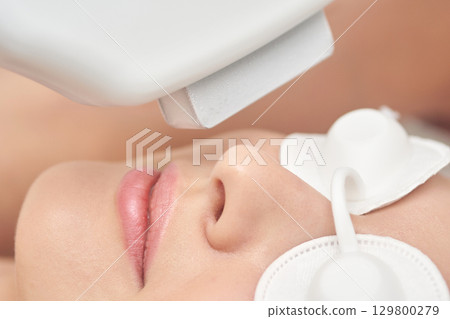 Close-up of female undergoing facial laser treatment for skin care Close-up of female undergoing facial laser treatment for skin care 129800279