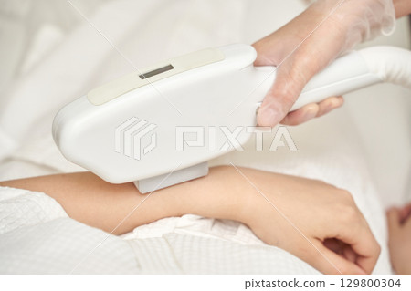 Female receiving laser hair removal treatment on arm in spa setting 129800304
