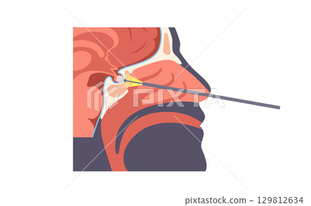 Pituitary gland surgery 129812634