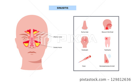 Sinusitis medical poster 129812636