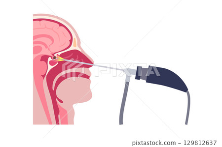 Pituitary gland surgery Pituitary gland surgery 129812637