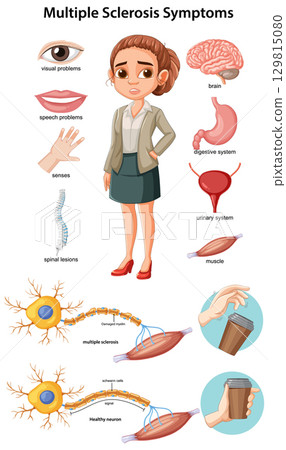Vector Illustration of Multiple Sclerosis Symptoms and Effects 129815080