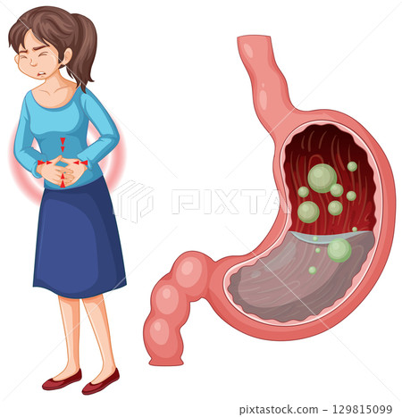 Stomach Pain and Digestive System Illustration 129815099