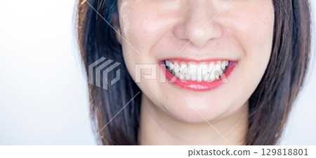 口腔護理 129818801