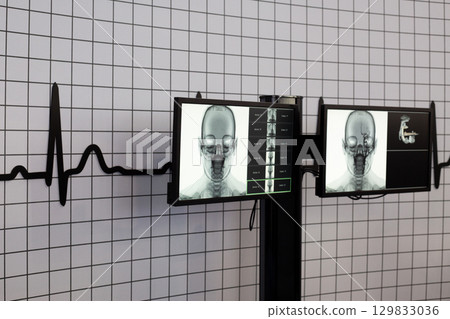 Medical diagnostic equipment showing 3D scan of skull and brain, with X ray images displayed on monitors. Grid background and heartbeat line symbolize health and advanced technology in medicine Medical diagnostic equipment showing 3D scan of skull and brain, with X ray images displayed on monitors. Grid background and heartbeat line symbolize health and advanced technology in medicine 129833036