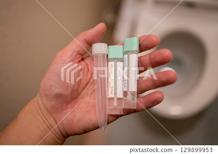 Urine and stool tests Urine and stool tests 129899953