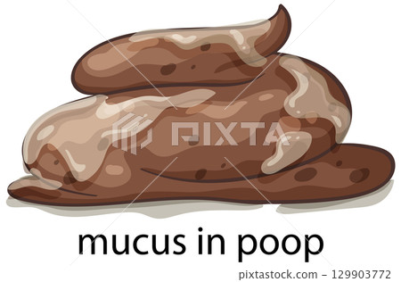 Illustration of Mucus in Stool 129903772