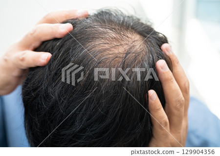 Bald in the middle head and begin no loss hair glabrous of mature Asian business smart active office man. 129904356