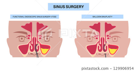 Minimally invasive endoscopic procedures 129906954