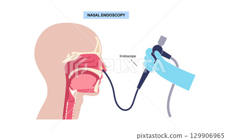 Nasal endoscopy poster 129906965