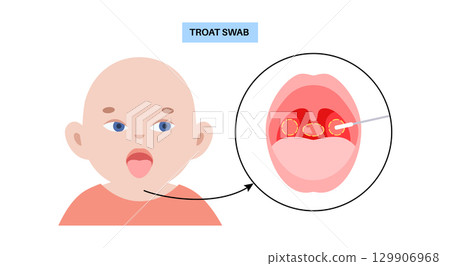 Swab throat procedure 129906968