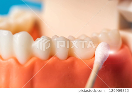Bacterial culture from dental pocket for aerobes, gingival fibromatosis, close-up Bacterial culture from dental pocket for aerobes, gingival fibromatosis, close-up 129909823