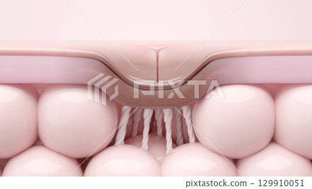 導致痤瘡疤痕（凹坑）的疤痕組織的橫截面 CG 129910051