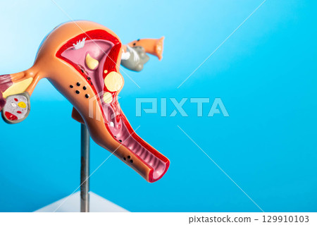 Model of female reproductive system on blue background. Concept of gynecological diseases research in medicine. Copy space for text, colposcopy 129910103