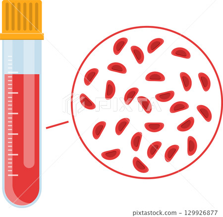 Blood sample in tube with magnified view of red blood cells for medical analysis and diagnosis. 129926877