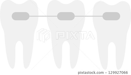 Three teeth with dental braces, aligned on a white background, representing orthodontics. 129927066