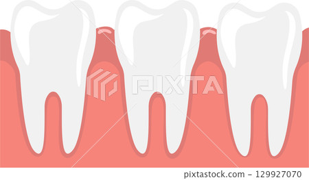 Illustration of three cartoon teeth set in gums. Good dental hygiene is very important, folks! Illustration of three cartoon teeth set in gums. Good dental hygiene is very important, folks! 129927070