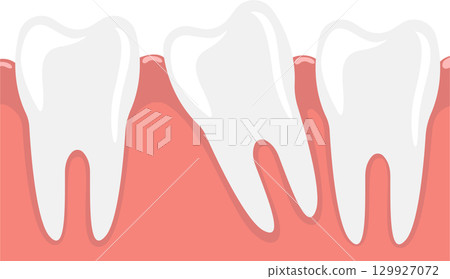 Misaligned teeth, also known as malocclusion, can cause problems with chewing, speaking, and cleaning. 129927072