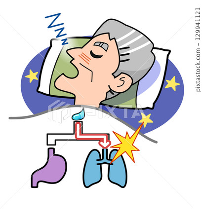 睡眠期間吸入 129941121