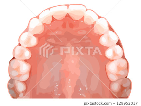 Upper jaw illustration Upper jaw illustration 129952017