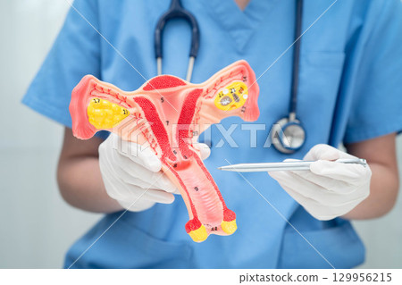 Uterus, doctor holding human anatomy model for study diagnosis and treatment in hospital. Uterus, doctor holding human anatomy model for study diagnosis and treatment in hospital. 129956215