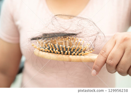 Asian woman have problem with long hair loss attach to comb brush. Asian woman have problem with long hair loss attach to comb brush. 129956238