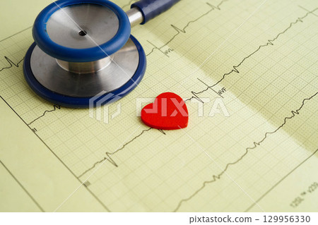 Stethoscope on electrocardiogram (ECG), heart wave, heart attack, cardiogram report. 129956330