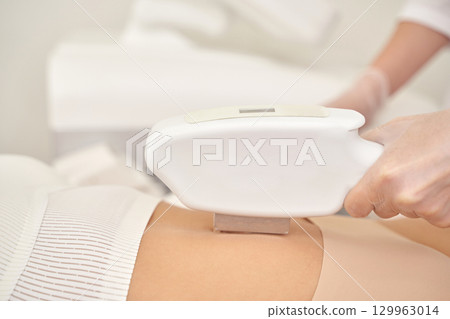 Female receiving laser hair removal on abdomen in spa treatment session Female receiving laser hair removal on abdomen in spa treatment session 129963014