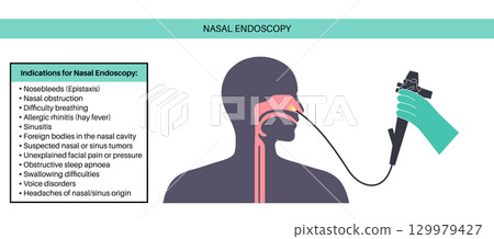 Nasal endoscopy poster 129979427