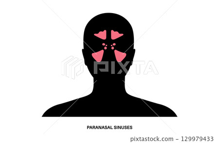 Paranasal sinus poster 129979433