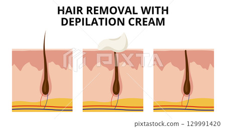 Depilation cream dissolving hair on skin 129991420