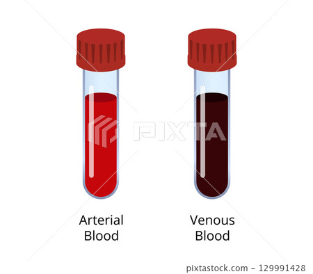 Comparing arterial and venous blood samples in test tubes 129991428
