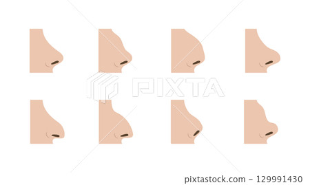 Various Nose Shapes Representing Rhinoplasty Options for Diverse Patients 129991430