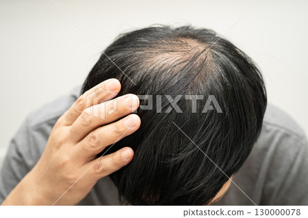 Bald in the middle head and begin no loss hair glabrous of mature Asian business smart active office man. 130000078