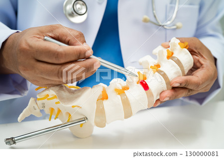 Doctor with lumbar vertebra bone skeleton and nerve model for treatment in the orthopedic department. 130000081