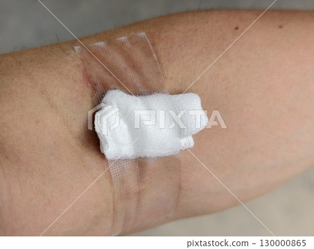 Arm with Cotton and Tape After Blood Donation. Close Up View 130000865