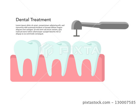 Dental Treatment flat vector illustration stock illustration Dental Treatment flat vector illustration stock illustration 130007585