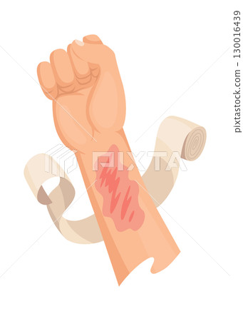 Hands injured skin and procedures of bandaging. First aid for wound. Medicine cure or treatment. First emergency help for human hand trauma Hands injured skin and procedures of bandaging. First aid for wound. Medicine cure or treatment. First emergency help for human hand trauma 130016439