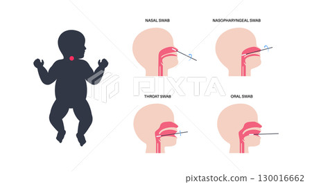 swab medical procedure 130016662
