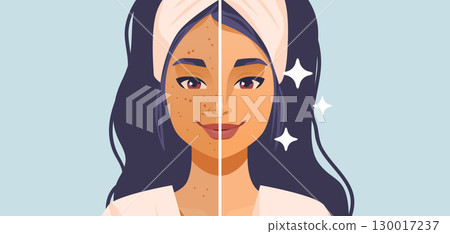 Woman skincare before and after acne treatment facial split clean glowing skin beauty transformation headband flat color background Woman skincare before and after acne treatment facial split clean glowing skin beauty transformation headband flat color background 130017237