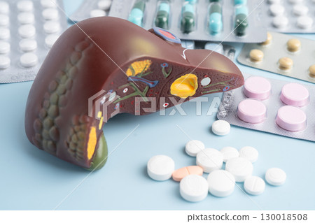 Liver model with pill drug treatment, Cirrhosis, Liver cancer, fatty liver. 130018508