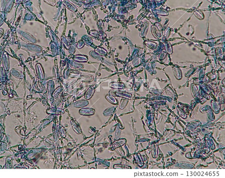 A mold that grows by spreading hyphae on leaves 130024655