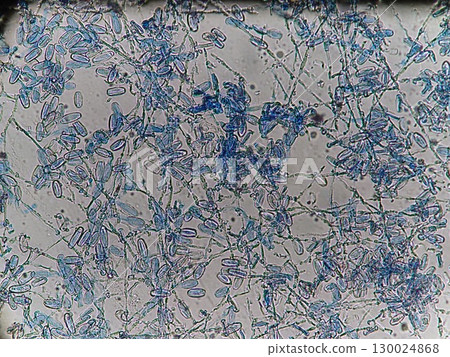 Spreading of powdery mildew hyphae 130024868