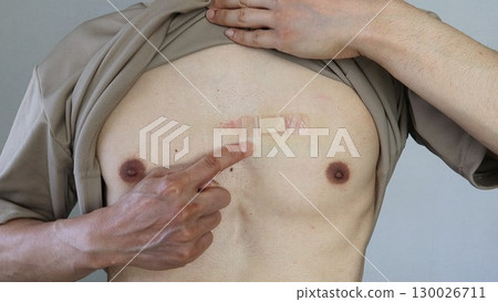 A person pointing at a bandage on their body A person pointing at a bandage on their body 130026711