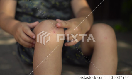 the boy sits on the porch on a hot summer day gently touching a scab on his knee with his finger the camera slowly zooms in toward his face 130037554
