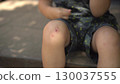 a child sits on the porch on a hot summer day he touches his scraped knee with his finger in close up wearing a t shirt and shorts 130037555