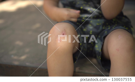 a child sits on the porch on a hot summer day he touches his scraped knee with his finger in close up wearing a t shirt and shorts a child sits on the porch on a hot summer day he touches his scraped knee with his finger in close up wearing a t shirt and shorts 130037555