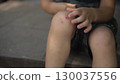 a child sits on the porch on a hot summer day he touches his scraped knee with his finger in close up wearing a t shirt and shorts 130037556