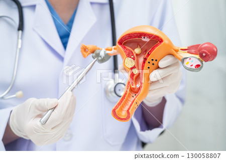 Uterus, doctor holding human anatomy model for study diagnosis and treatment in hospital. 130058807