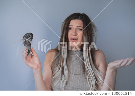 Young woman showing severe hair loss after brushing strands concerned about hair breakage and thinning 130061814
